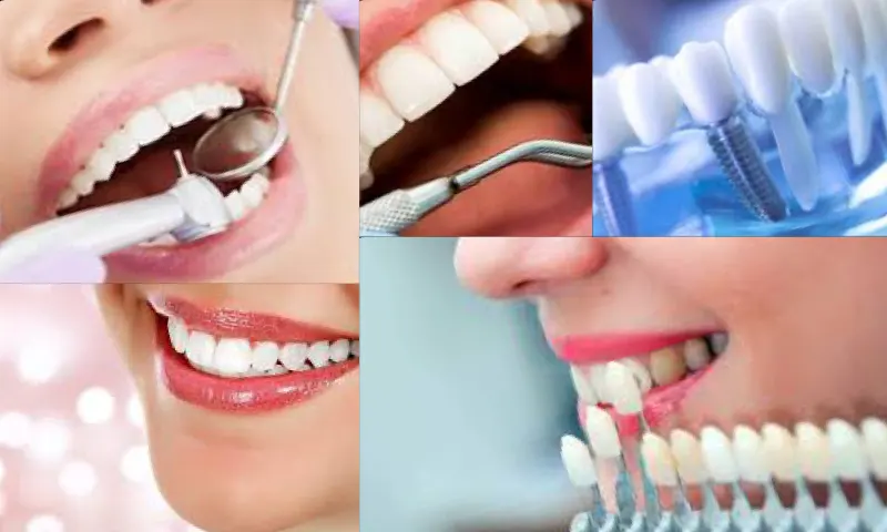 Ankara Diş Tedavisi Fiyatları