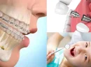 Düzce Çocuk Diş Hastanesi Hangi Tedaviler Sunuluyor?
