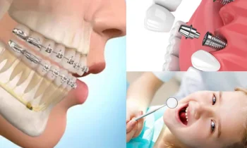 Düzce Çocuk Diş Hastanesi Hangi Tedaviler Sunuluyor?