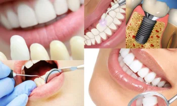 Kanal Tedavisinin Amacı Nedir?