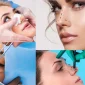Türkiye'de Rinoplasti - Rhinoplasty in Turkey Var Mıdır?