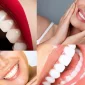 Türkiye'de Diş Kliniği - Dental Clinic in Turkey Nasıl Bulunur?