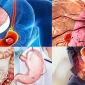Types of Liver Cancer
